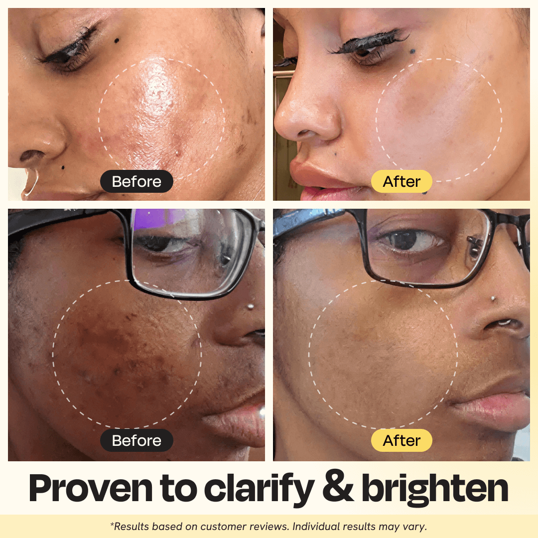 Vitamin C Clay Mask — Brighten, Clear & Even Skin Tone in 10 Minutes