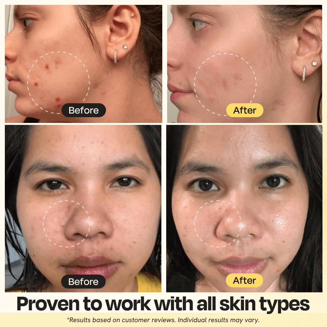 Vitamin C Clay Mask — Brighten, Clear & Even Skin Tone in 10 Minutes
