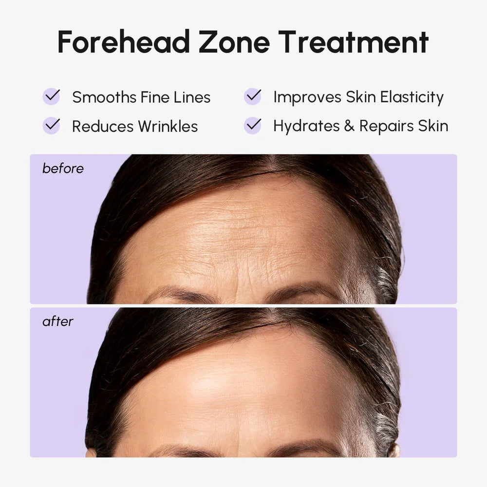 Anti-Wrinkle Forehead Patches — Smooth & Lift Overnight
