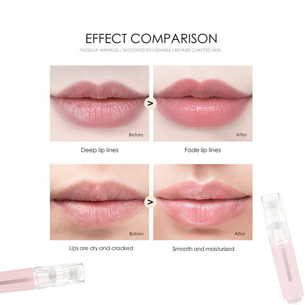 High Frequency Vibration Lip Massager — Plump & Hydrate Your Lips