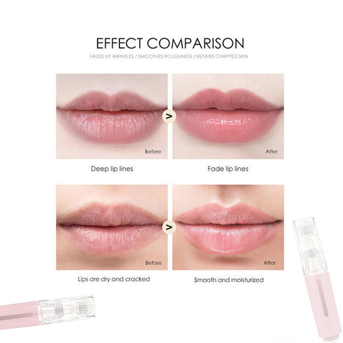 High Frequency Vibration Lip Massager — Plump & Hydrate Your Lips